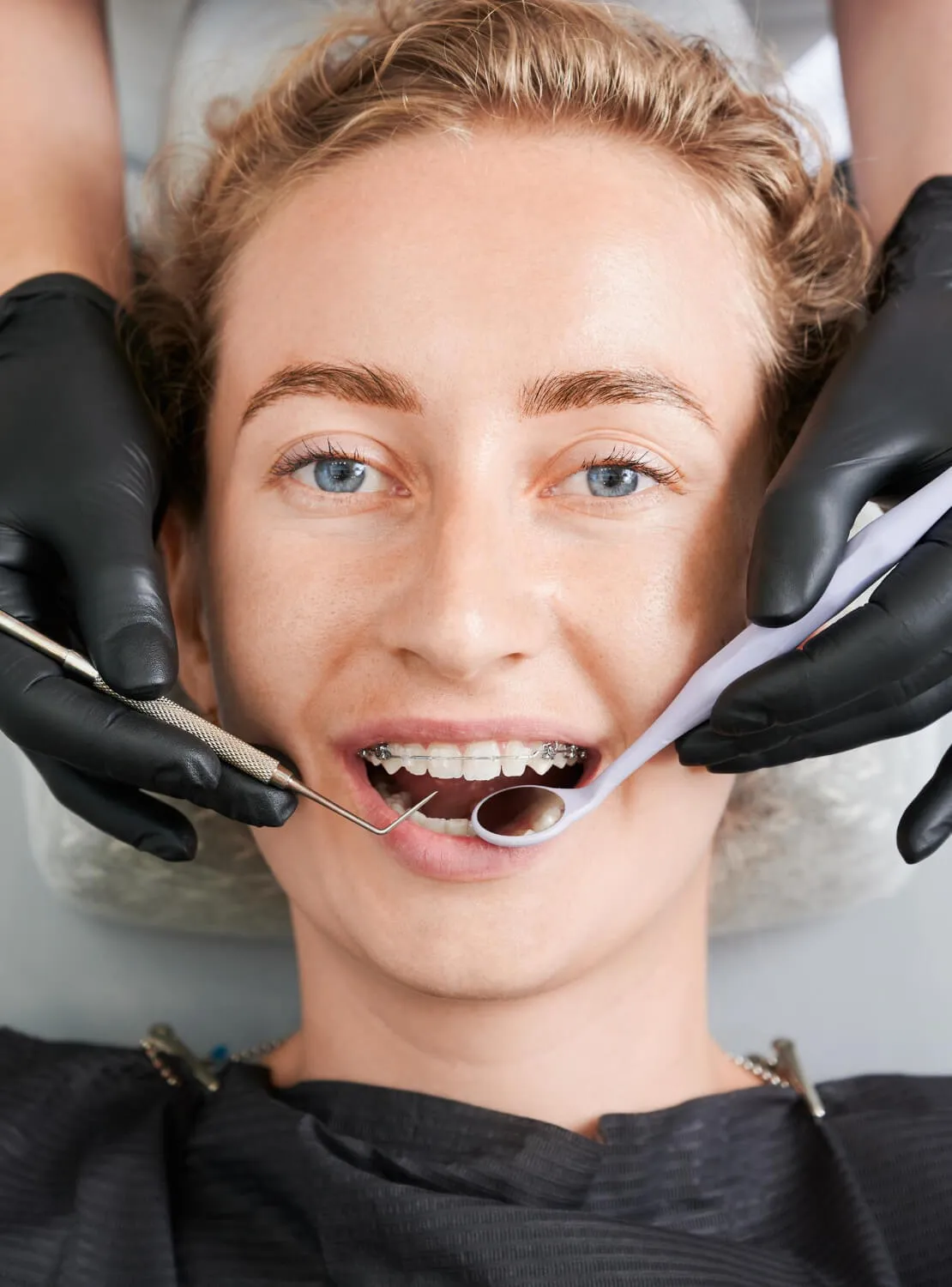 tratamientos de estética dental en el barrio de salamanca