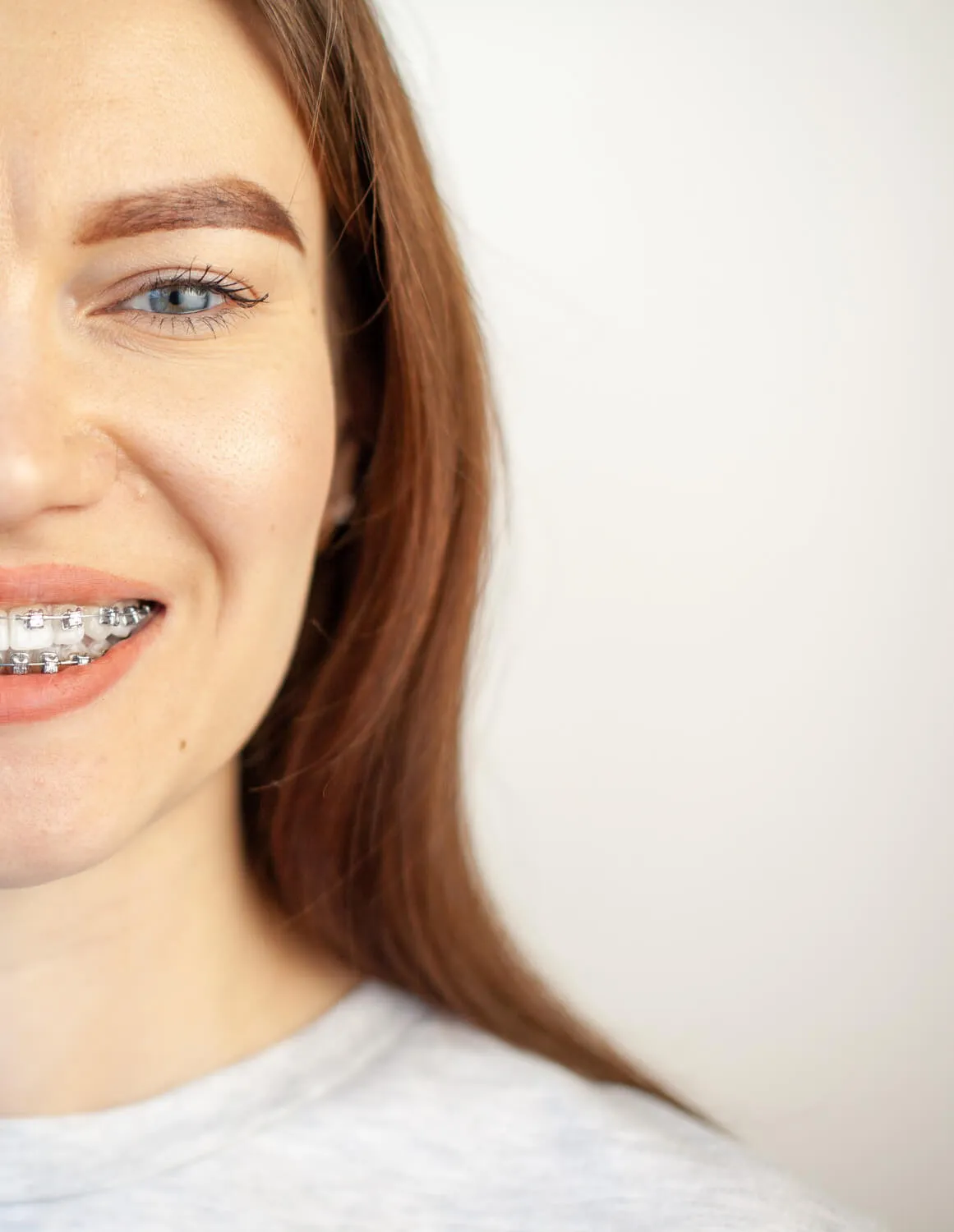 tratamientos de estética dental en el barrio de salamanca